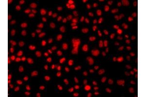 Immunofluorescence analysis of  cells using hnRNP  antibody (ABIN6128029, ABIN6141896, ABIN6141899 and ABIN6223388). (HNRNPA1 Antikörper  (AA 1-372))