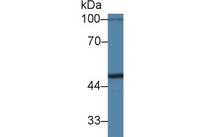 Detection of PIM1 in Mouse Cerebrum lysate using Polyclonal Antibody to Pim-1 Oncogene (PIM1) (PIM1 Antikörper  (AA 122-261))