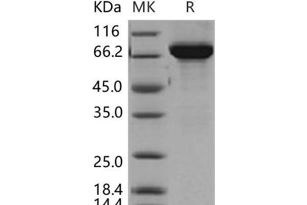 Thimet Oligopeptidase 1 Protein (THOP1) (His tag)