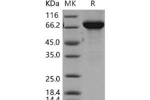 Western Blotting (WB) image for Thimet Oligopeptidase 1 (THOP1) (Active) protein (His tag) (ABIN7198217)