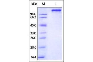 SDS-PAGE (SDS) image for Epidermal Growth Factor Receptor (EGFR) (AA 25-645) (Active) protein (Fc Tag) (ABIN2870847)