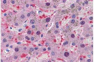 Immunohistochemistry (Formalin-fixed Paraffin-embedded Sections) (IHC (fp)) image for anti-Aldo-Keto Reductase Family 1, Member B10 (Aldose Reductase) (AKR1B10) (AA 76-144) antibody (ABIN574456)