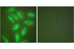 Immunofluorescence analysis of HeLa cells, using Keratin 18 antibody (ABIN5976438). (Cytokeratin 18 Antikörper  (C-Term))