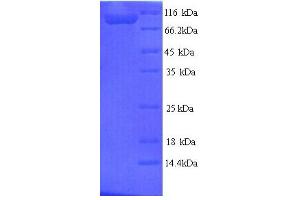 SDS-PAGE (SDS) image for tau Protein (AA 2-752) protein (His tag) (ABIN5713630) (tau Protein (AA 2-752) (His tag))