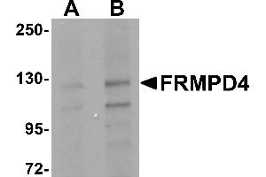 Western Blotting (WB) image for anti-FERM and PDZ Domain Containing 4 (FRMPD4) (Middle Region) antibody (ABIN1030935) (FRMPD4 Antikörper  (Middle Region))