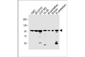 All lanes : Anti-DNAJC6 Antibody (Center) at 1:2000 dilution Lane 1: K562 whole cell lysate Lane 2: SH-SY5Y whole cell lysate Lane 3: U-87 MG whole cell lysate Lane 4: HL-60 whole cell lysate Lane 5: mouse cerebellum lysate Lane 6: mouse brain lysate Lane 7: rat cerebellum lysate Lysates/proteins at 20 μg per lane.