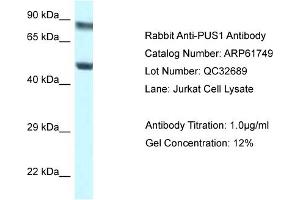 Western Blotting (WB) image for anti-Pseudouridylate Synthase 1 (PUS1) (N-Term) antibody (ABIN2788888)