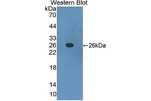 Western Blotting (WB) image for anti-Interferon alpha/beta Receptor 1 (IFNAR1) (AA 28-227) antibody (ABIN1859262) (IFNAR1 Antikörper  (AA 28-227))
