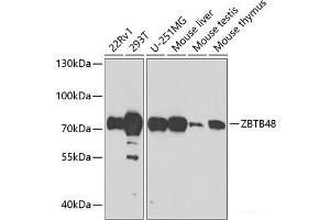 Western blot analysis of extracts of various cell lines using ZBTB48 Polyclonal Antibody at dilution of 1:1000. (ZBTB48 Antikörper)