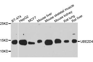Western blot analysis of extracts of various cell lines, using UBE2D4 antibody (ABIN5974832) at 1/1000 dilution. (UBE2D4 Antikörper)