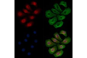 Phospho-TOP2A (Ser1106) Antibody staining Hela cells(heat shock treatment) by IF/ICC.