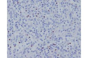 Immunohistochemical analysis of paraffin-embedded human spleen, using TBX21 Antibody.