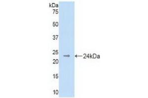 Detection of Recombinant DHH, Mouse using Polyclonal Antibody to Hedgehog Homolog, Desert (DHH) (desert Hedgehog Antikörper  (AA 212-392))