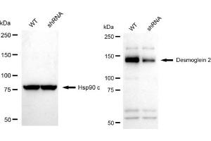 Western blotting analysis using Desmoglein 2 antibody (ABIN7798317). (Rekombinanter Desmoglein 2 Antikörper)