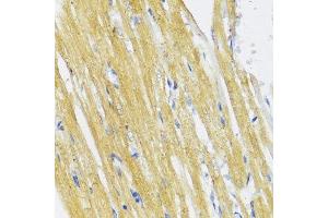 Immunohistochemistry of paraffin-embedded rat heart using IKBKE antibody. (IKKi/IKKe Antikörper  (AA 495-716))