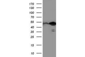 Western Blotting (WB) image for anti-T-Cell Acute Lymphocytic Leukemia 1 (TAL1) antibody (ABIN1501292) (TAL1 Antikörper)