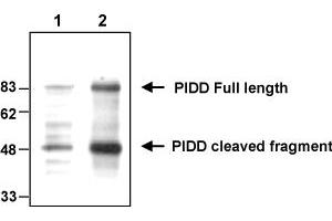 Western blot analysis of endogenous and overexpressed human PIDD using MAb to PIDD (Anto-1) . (PIDD Antikörper  (AA 776-910))