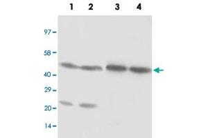 Western blot analysis of cell and tissue lysates with NR1H3 polyclonal antibody . (NR1H3 Antikörper  (C-Term))