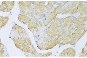 Immunohistochemistry of paraffin-embedded Rat heart using DENR Polyclonal Antibody at dilution of 1:150 (40x lens). (Density Regulated Protein Antikörper)