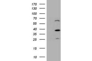 HEK293T cells were transfected with the pCMV6-ENTRY control (Left lane) or pCMV6-ENTRY DTNB (Right lane) cDNA for 48 hrs and lysed. (Dystrobrevin beta Antikörper)