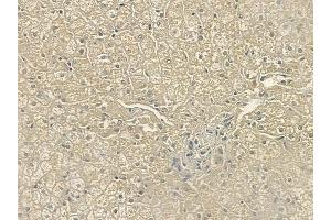 ABIN6259270 and ABIN6274431 at 1/100 staining human normal liver tissue by IHC-P. (PPHLN1 Antikörper  (N-Term))