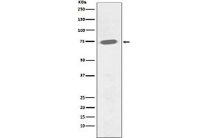 Western blot analysis of Phospho-BTK (Y551) expression in Ramos cell lysate treated with Pervanadate.