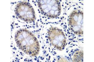 Immunohistochemistry of paraffin-embedded Human colon using GTF2F2 Polyclonal Antibody at dilution of 1:200 (40x lens).