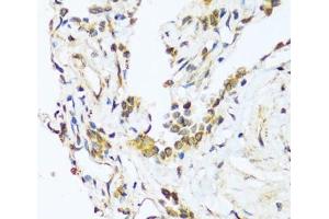 Immunohistochemistry of paraffin-embedded Human lung using BAG3 Polyclonal Antibody at dilution of 1:100 (40x lens). (BAG3 Antikörper)