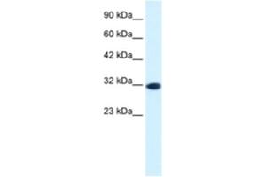 Western Blotting (WB) image for anti-Empty Spiracles Homeobox 2 (EMX2) antibody (ABIN2460259) (EMX2 Antikörper)