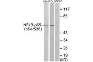 Western blot analysis of extracts from K562 cells and COLO cells, using NF-kappaB p65 (Phospho-Ser536) Antibody.