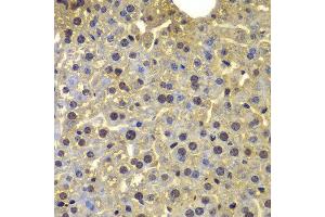 Immunohistochemistry of paraffin-embedded mouse liver using SORT1 antibody at dilution of 1:100 (40x lens).