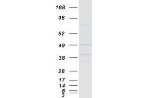 Western Blotting (WB) image for Protein Kinase, CAMP Dependent, Catalytic, beta (PRKACB) (Transcript Variant 2) protein (Myc-DYKDDDDK Tag) (ABIN2729577)
