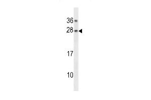 Western blot analysis in K562 cell line lysates (35ug/lane). (GAR1 Antikörper  (AA 86-114))