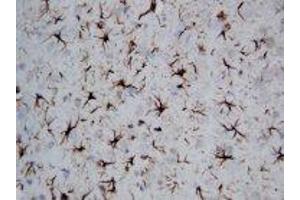 Image no. 1 for anti-Glial Fibrillary Acidic Protein (GFAP) (C-Term) antibody (ABIN1493067) (GFAP Antikörper  (C-Term))