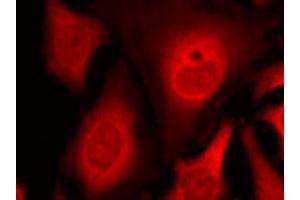 Immunofluorescence staining of methanol-fixed HeLa cells using EIF2S1 (phospho S49) polyclonal antibody (Cat # PAB25902, red). (EIF2S1 Antikörper  (pSer49))
