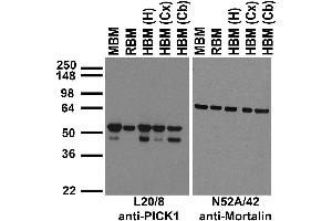 Immunoblot against crude membrane fractions from whole mouse (MBM) or rat (RBM) brain and from human hippocampus [HBM(H)], cerebral cortex [HBM(Cx)] or cerebellum [HBM(Cb)] and probed with L20/8 (left) or N52A/42 (right) TC supe.
