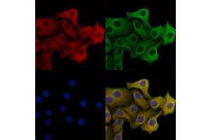 PERK Mouse monoclonal Antibody staining Hela cells by IF/ICC.