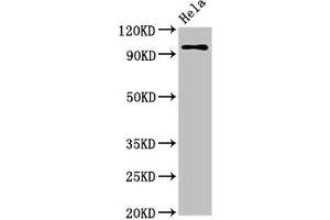 Western Blot Positive WB detected in: Hela whole cell lysate All lanes: CLOCK antibody at 3. (CLOCK Antikörper  (AA 577-846))