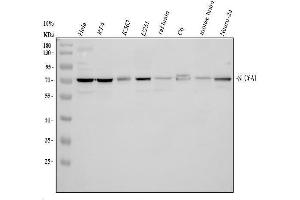 Western blot analysis of SLC6A1 using anti-SLC6A1 antibody (ABIN5518957). (SLC6A1 Antikörper  (N-Term))