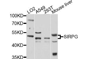 Western blot analysis of extracts of various cell lines, using SIRPG antibody (ABIN1876133) at 1:1000 dilution. (SIRPG Antikörper)