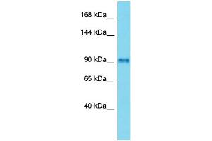 Host: Rabbit Target Name: FSIP2 Sample Type: Placenta lysates Antibody Dilution: 1. (FSIP2 Antikörper  (C-Term))
