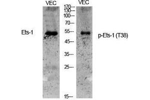 Western Blot (WB) analysis of specific cells using Phospho-Ets-1 (T38) Polyclonal Antibody. (ETS1 Antikörper  (pThr38))
