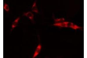ABIN6275278 staining HepG2 cells by IF/ICC. (CYB5R3 Antikörper  (C-Term))
