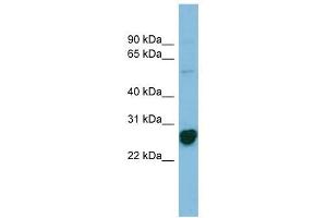 RPL10A antibody used at 1 ug/ml to detect target protein. (RPL10A Antikörper  (N-Term))