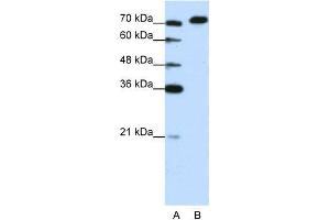 Human Jurkat; WB Suggested Anti-AKAP8L Antibody Titration: 1. (AKAP8L Antikörper  (C-Term))
