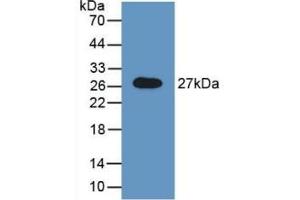 Detection of Recombinant GAS, Rat using Polyclonal Antibody to N-Acetylgalactosamine-6-Sulfatase (GALNS) (GALNS Antikörper  (AA 172-381))