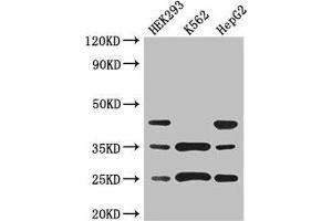 Western Blot Positive WB detected in: HEK293 whole cell lysate, K562 whole cell lysate, HepG2 whole cell lysate All lanes: PCTP antibody at 3 μg/mL Secondary Goat polyclonal to rabbit IgG at 1/50000 dilution Predicted band size: 25, 17 kDa Observed band size: 25, 35, 45 kDa (PCTP Antikörper  (AA 1-214))