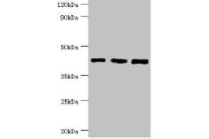 Western blot All lanes: SWI/SNF-related matrix-associated actin-dependent regulator of chromatin subfamily B member 1 antibody at 8 μg/mL Lane 1: Hela whole cell lysate Lane 2: 293T whole cell lysate Lane 3: Mouse stomach tissue Secondary Goat polyclonal to rabbit IgG at 1/10000 dilution Predicted band size: 45, 44 kDa Observed band size: 45 kDa (SMARCB1 Antikörper  (AA 86-385))