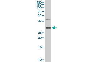 PITX1 MaxPab rabbit polyclonal antibody. (PITX1 Antikörper  (AA 1-314))