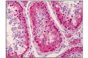Human Testis: Formalin-Fixed, Paraffin-Embedded (FFPE) (NANOS3 Antikörper  (C-Term))